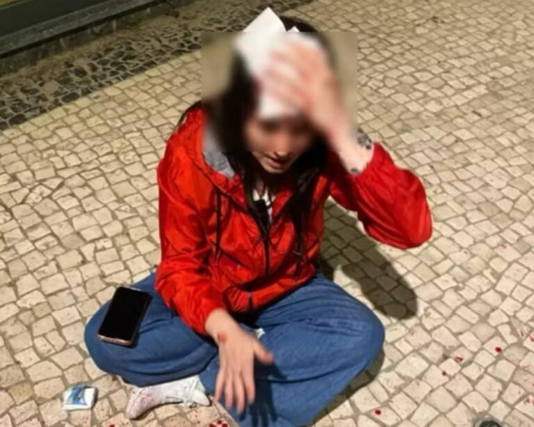Brasileira leva pedrada na cabeça em rua movimentada de Porto, Portugal