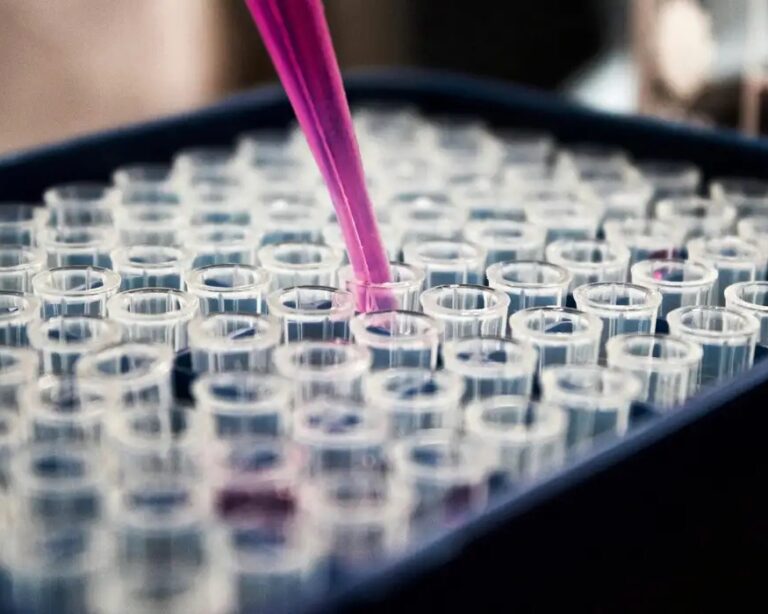 Cientistas brasileiros avançam em exame de sangue para diagnóstico do Alzheimer