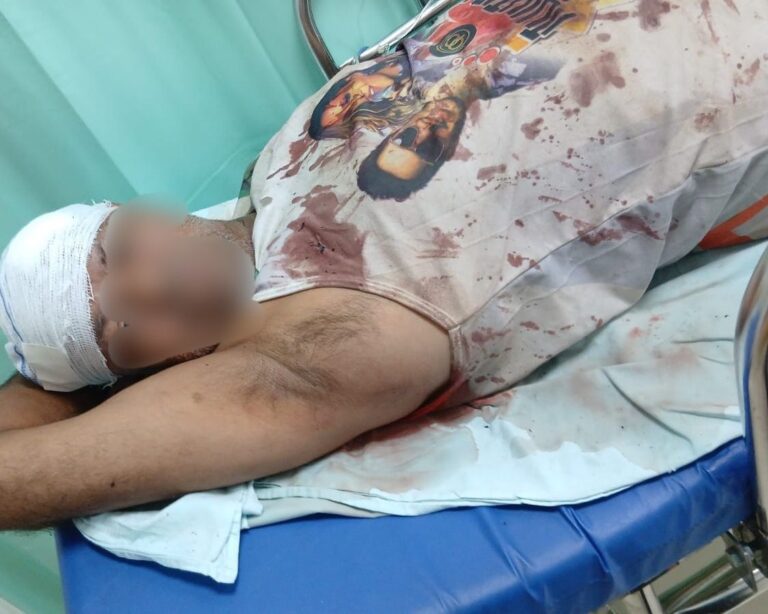 Homem é brutalmente atingido na cabeça durante ataque no bairro Brasil, Ituiutaba