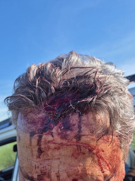 Homem leva tiro na cabeça na região do São Lourenço durante venda de fazenda