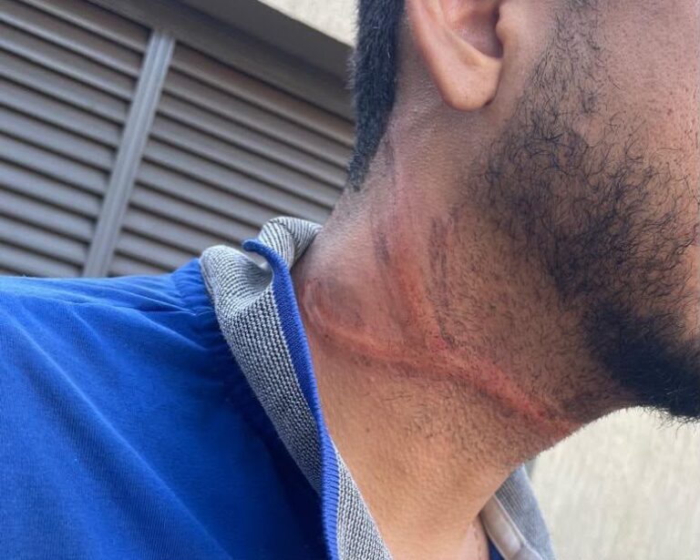 Motociclista fica ferido após cabo de internet caído se enroscar em seu pescoço em Ituiutaba